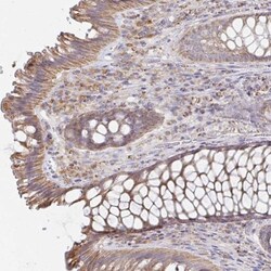 NKX2.8 Antibody, Novus Biologicals:Antibodies:Primary Antibodies